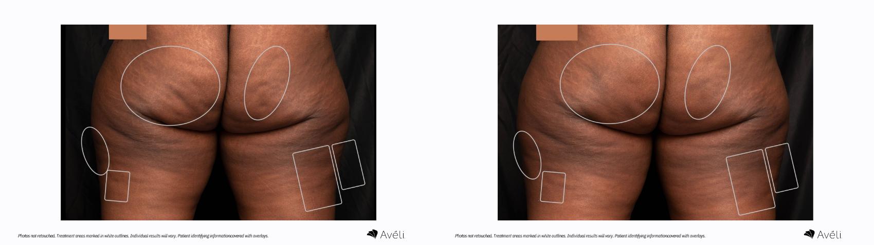 Before & After Avéli Case 470 Back View in Houston, TX