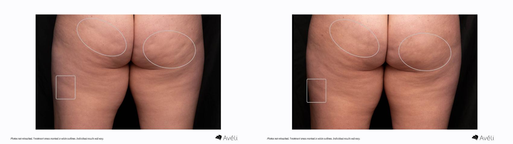 Before & After Avéli Case 471 Back View in Houston, TX