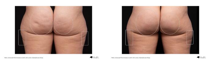 Before & After Avéli Case 473 Back View in Houston, TX