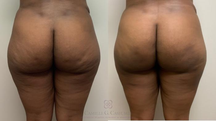 Before & After Avéli Case 496 back 2 View in Houston, TX