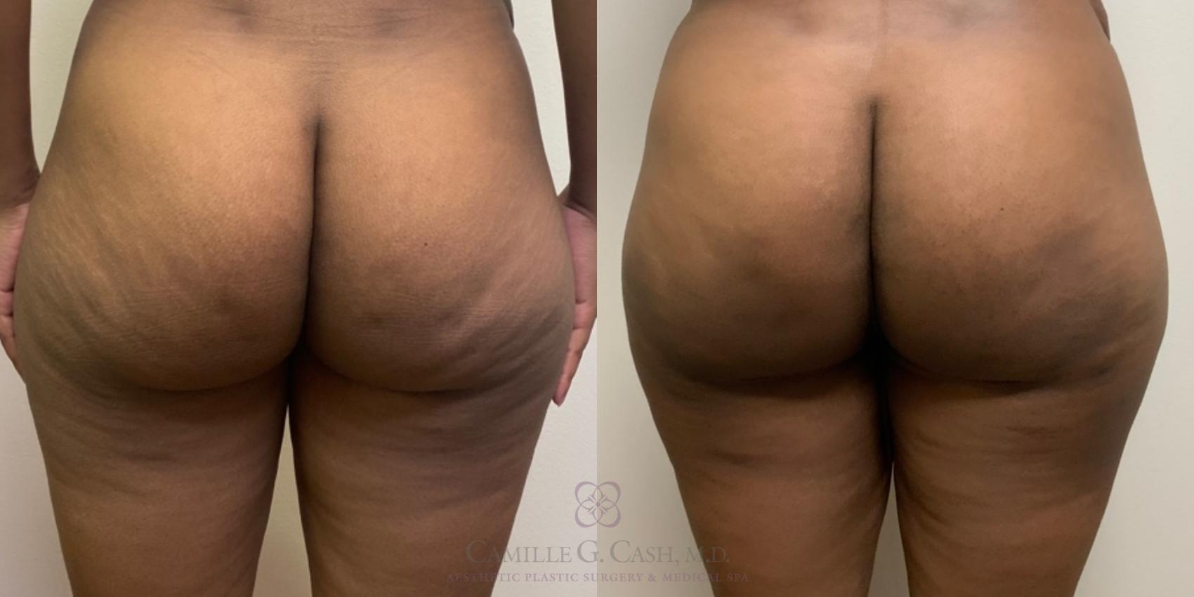 Before & After Avéli Case 496 Back View in Houston, TX