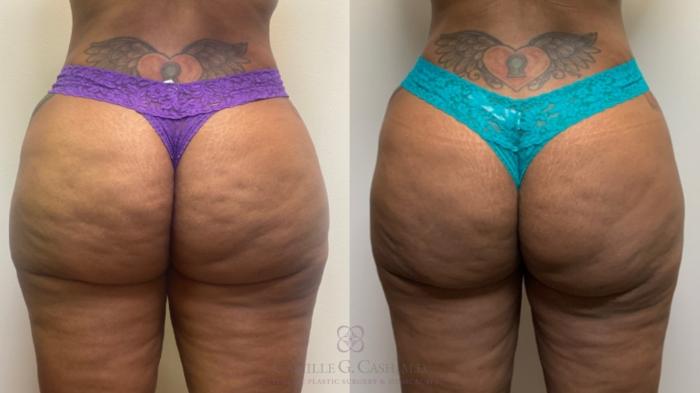 Before & After Avéli Case 497 Back View in Houston, TX