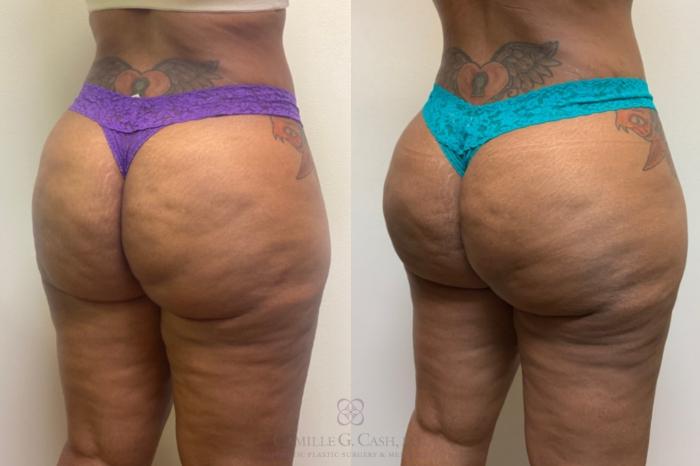 Before & After Avéli Case 497 Right Oblique View in Houston, TX