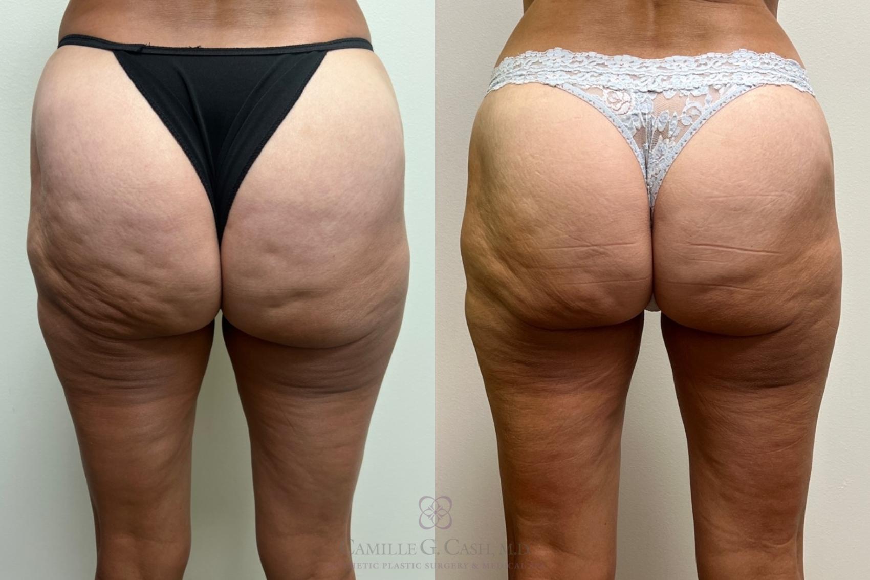 Before & After Avéli Case 527 back 2 View in Houston, TX