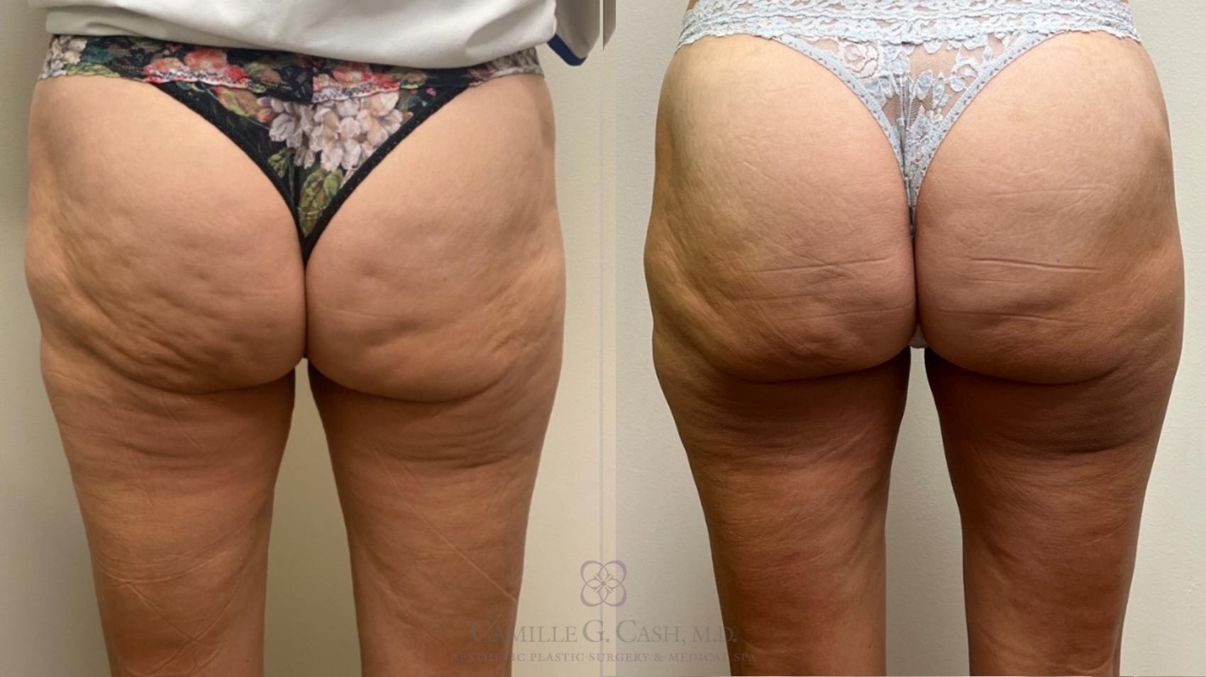 Before & After Avéli Case 527 Back View in Houston, TX