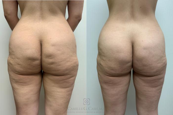 Before & After Avéli Case 619 Back View in Houston, TX