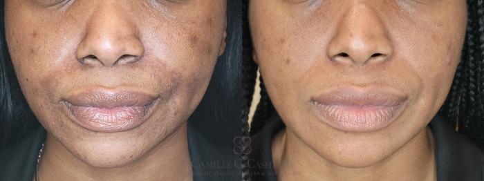 Before & After Skin Care Case 650 front bottom View in Houston, TX
